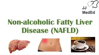 Non-Alcoholic Fatty Liver Disease, Risk Factors, Symptoms (ex. Fatigue), Treatment (ex. Coffee)