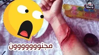 قطع يده بالسكين+18 😢 - الفنان عبدالباسط