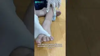 Cek saraf terjepit jari kaki 