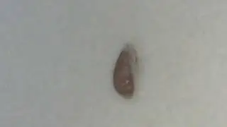 Hoofdluis