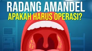 Tonsillitis: Does Surgery Require?