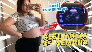 DESEJO, INSÔNIA E TAMANHO DO BEBÊ | Diário da Gravidez