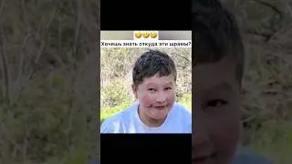 Хочешь знать, откуда эти шрамы? 
