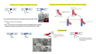 Isolated ostial LAD or ostial LCx stenting