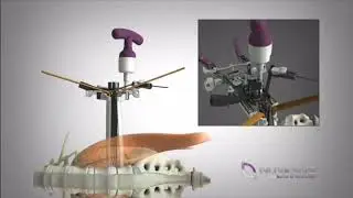 XLIF - Procedural Animation
