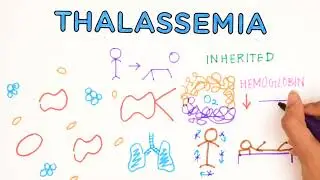 All About Thalassemia