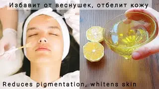 How to Make Lemon Oil At Home| Get Rid Of Pigmentation,  Freckles