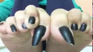 Long toenails scratching