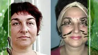 girudocentr 10 20