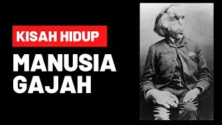 THE ELEPHANT MAN | Kisah PILU Manusia Gajah #inabercerita
