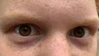 Fen being Fen | Part 2