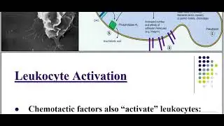 Pathology of Inflammation Acute Inflammation callular Events