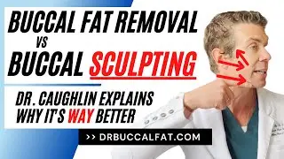 Buccal Fat Removal | Difference between Removal and Sculpting #buccalfatremoval #buccalfatsculpting