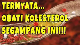 TERNYATA, Obat Kolesterol Alami Bisa Semudah Ini!