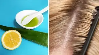 Старинный рецепт от перхоти. Перхоть исчезнет - средство избавляет от перхоти и выпадения волос