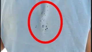 ПОСЛЕДСТВИЯ ВЫСТРЕЛА ИЗ ДРОБОВИКА