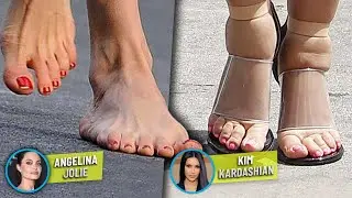 Así lucen realmente los pies de estas famosas