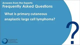 Rare Variant: Primary Cutaneous Anaplastic Large Cell Lymphoma