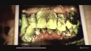 Until Dawn PL  -  Wydarzenia z przeszłości