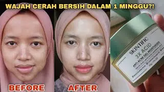 CREAM WAJAH TERBARU❗️AMPUH MENGATASI JERAWAT & MENCERAHKAN