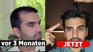 Grow hair 3x faster – My personal experience & tips