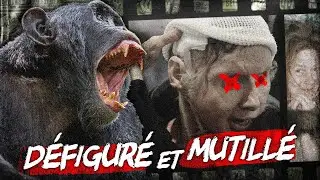 La femme qui a été DÉFIGURÉE ❌ par un CHIMPANZÉ