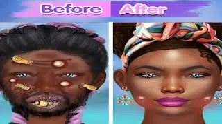 Cleared the shoulders and face benefits||Does Head and Shoulders clean your face? ||