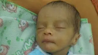 Prematur 7 bulan ( selamat jalan Thole AL, anakku sayang)