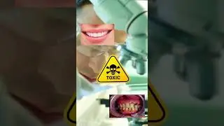 THE FLUORIDE THING 