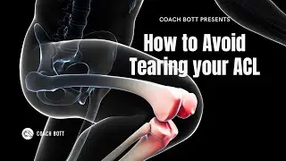 How to Avoid Tearing your ACL
