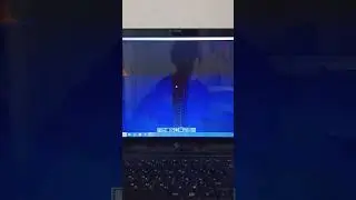 3  стадия 4 стадия