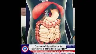 MGB in women: Weight loss and diabetes control at the centre of excellence in India