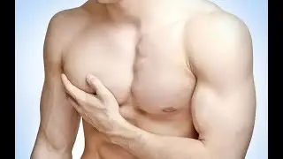 Лечение гинекомастии