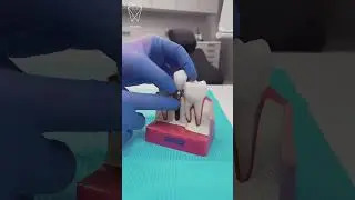 🦷  Имплантация зубов - что это такое?
