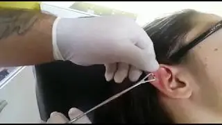 Kıkırdak Piercing ( Quter Conch Flat )