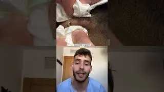 Pimple in barbershop 