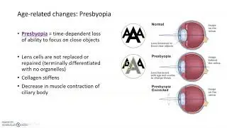 Aging Bodies: Changes to Vision
