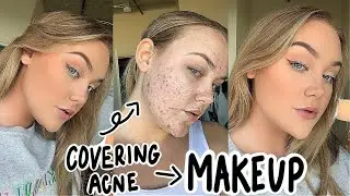 Makeup Routine For Covering Acne