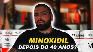 Tenho 40 anos, posso usar minoxidil?