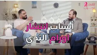 اسباب انتشار اورام الثدي د. اشرف نجيب / المخرج محمد رائد