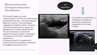 Рак гортани и ларингоцеле