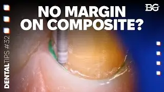 No margin on composite?