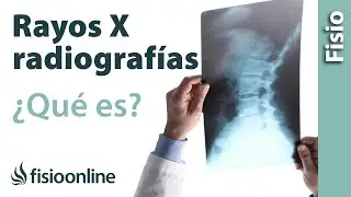 RX o radiografía - ¿Qué es y cómo funciona?