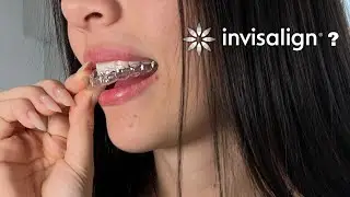 INVISALIGN: Mi experiencia | 10 meses | Ortodoncia invisible