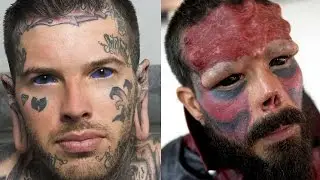 15 Most Shocking Body Modifications