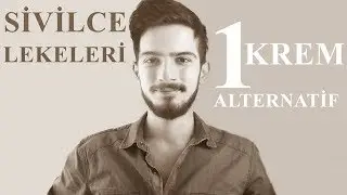 Sivilce Lekeleri ( 1 HAFTADA ) Nasıl Geçer ? │ Aras Barlas