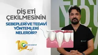 Diş Eti Çekilmesinin Sebepleri ve Tedavi Yöntemleri Nelerdir?
