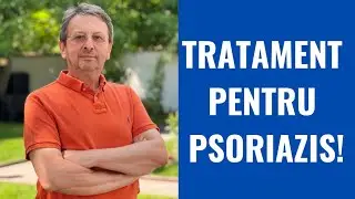 TREATMENT FOR PSORIASIS!