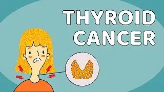 Thyroid Cancer: Most Commonly Asked Questions I Health and Nutrition