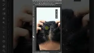 Remove Dandruff in Ps  